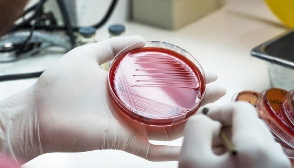 Old antibiotic compounds could become life-saving drugs - Pharma ...